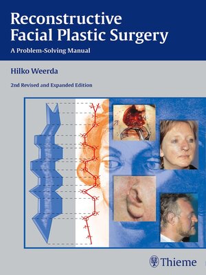 cover image of Reconstructive Facial Plastic Surgery